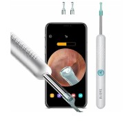 Умная ушная палочка Bebird R1 Smart Visual Spoon Ear Stick белая