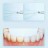 Электрический ирригатор для полости рта Xiaomi Mijia Portable Dental Rinser F400 MEO704 зеленый